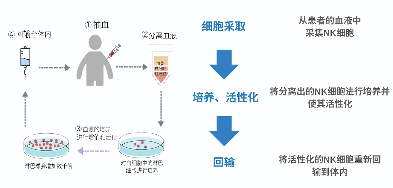 什么是免疫细胞治疗
